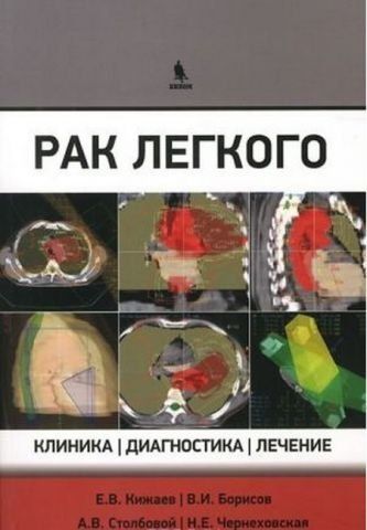 Рак лёгкого. Клиника, диагностика, лечение 135735 фото