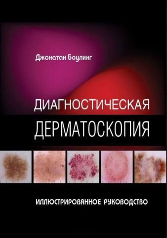 Диагностическая дерматоскопия. Иллюстрированное руководство 12779 фото