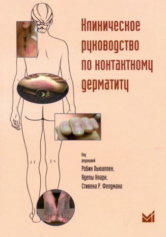 Клиническое руководство по контактному дерматиту. Диагностика и лечение в зависимости от области поражения 94388 фото
