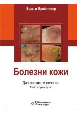 Болезни кожи. Диагностика и лечение. Атлас и руководство. 32323 фото